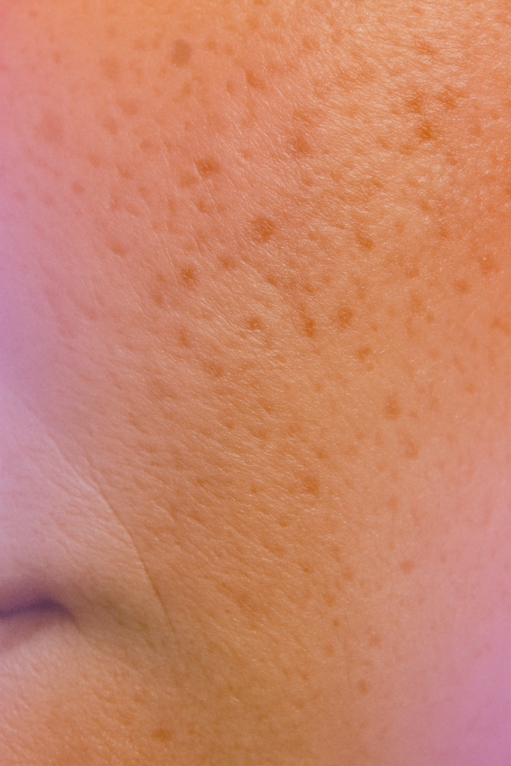 Real Skin Texture Trend